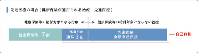 先進医療の場合