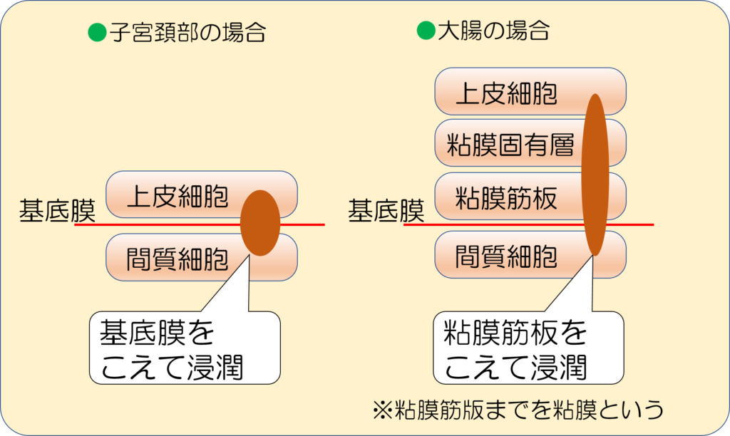 不確実な行動とは何ですか?